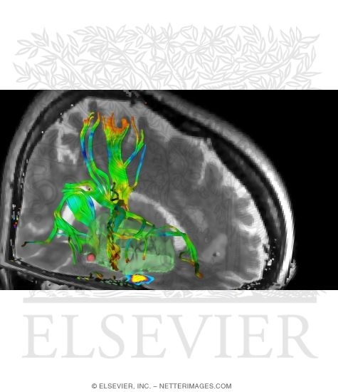 Watermarked preview of unlabeled image: Multimodal Image Guidance During Surgery