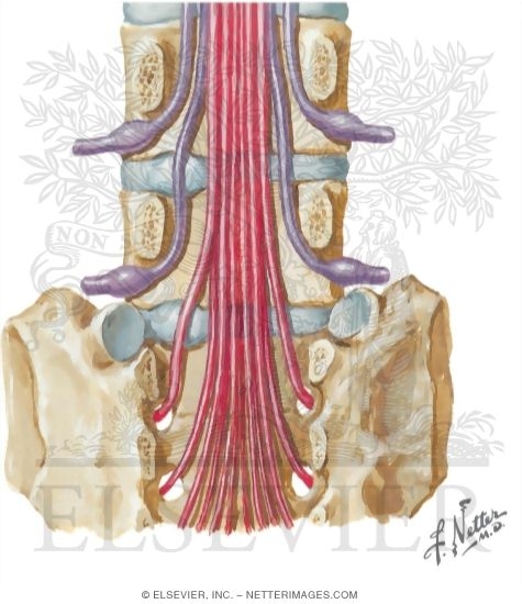 Lumbar Disk Protrusion