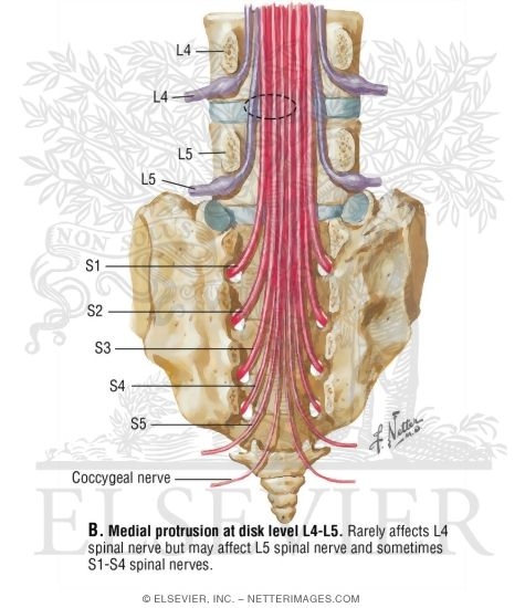 Spinal Nerves, Lumbar