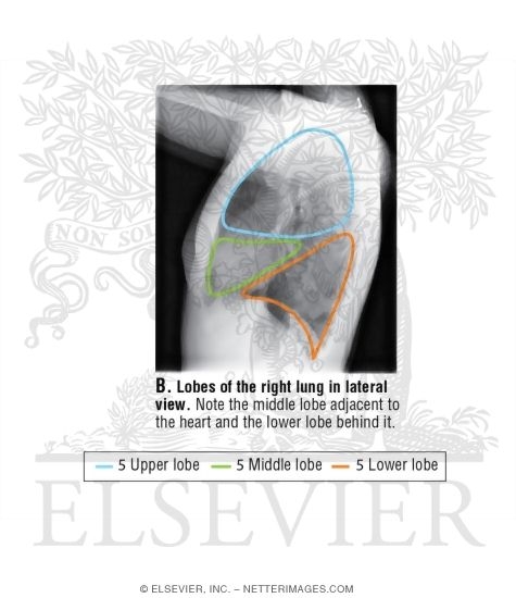 Lateral Chest X-Ray: Male
