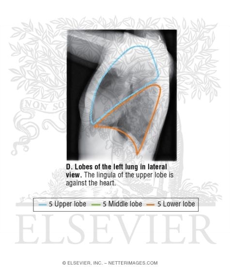 Lateral Chest X-Ray: Male