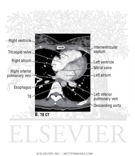 Watermarked preview of unlabeled image: CT of T8