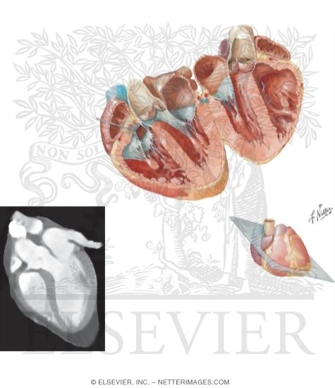 Atria, Ventricles, and Interventricular Septum