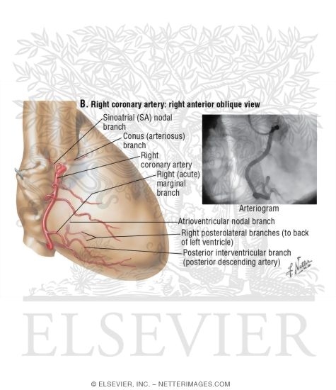 Right Coronary Artery: Right Anterior Oblique View