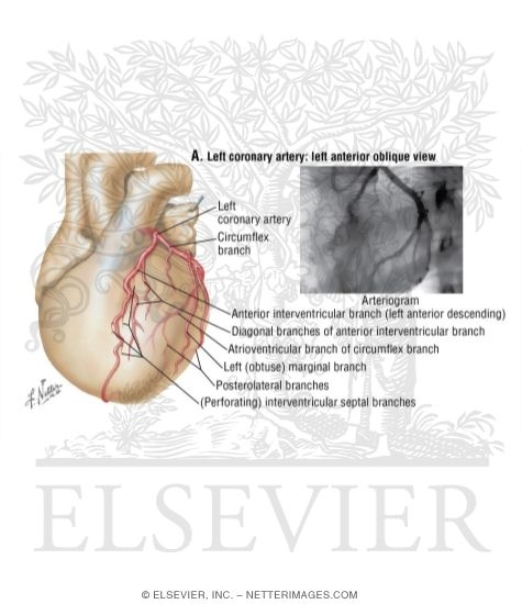 Left Coronary Artery: Left Anterior Oblique View