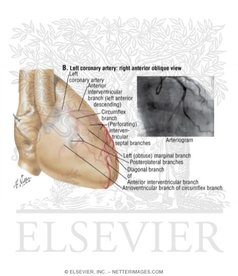 Left Coronary Artery: Right Anterior Oblique View