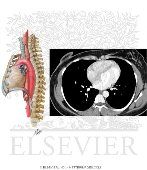 T7 Computed Tomography