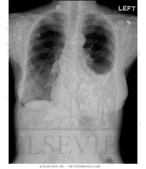Initial PA View