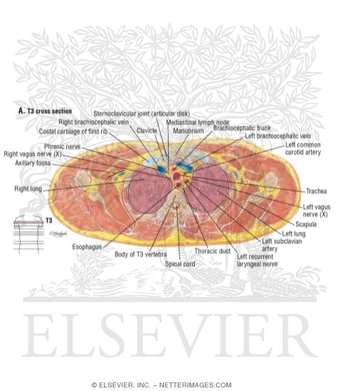 Watermarked preview of labeled image: Thorax: Brachiocephalic Vessels