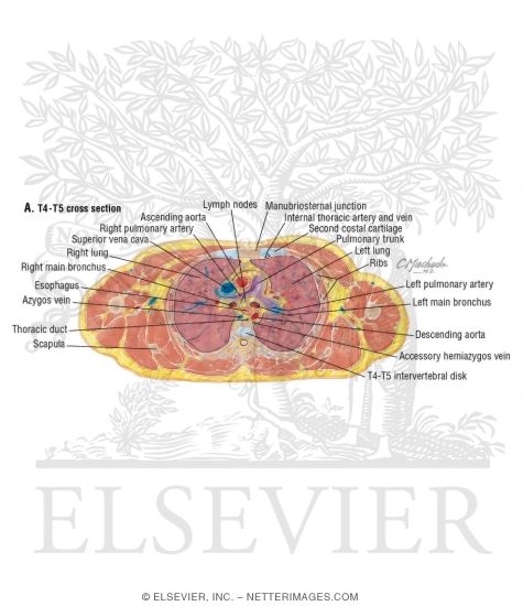 Watermarked preview of labeled image: Thorax: Pulmonary Trunk
