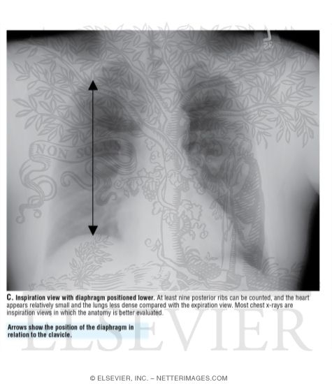 Watermarked preview of unlabeled image: Inspiration View With Diaphragm Positioned Lower