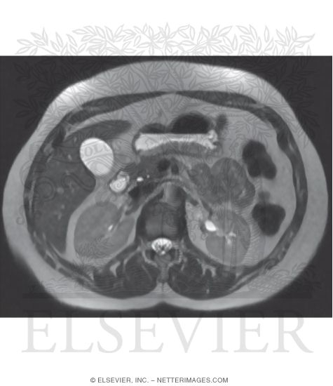 Ct Vs Mri In Abdominal Studies