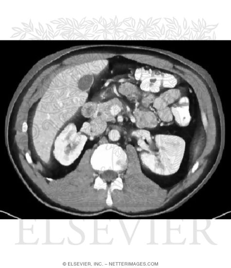 Pancreas Relationships