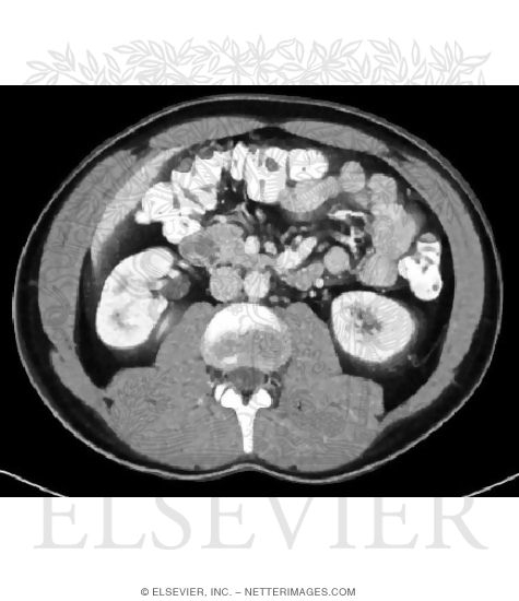 Pancreas Relationships