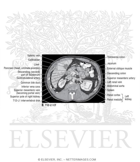 Watermarked preview of unlabeled image: Cross Section at T12-L1 With CT