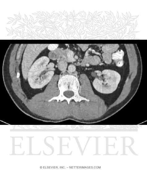 Kidney Relationships