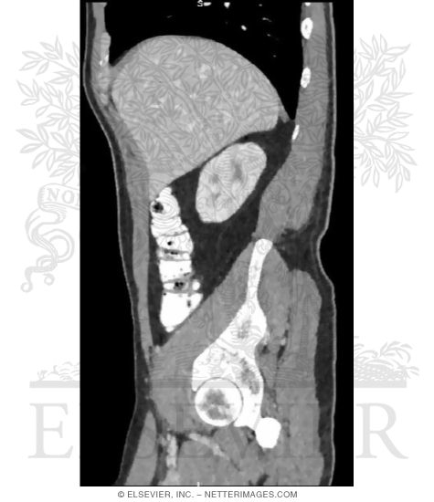 Kidney Relationships