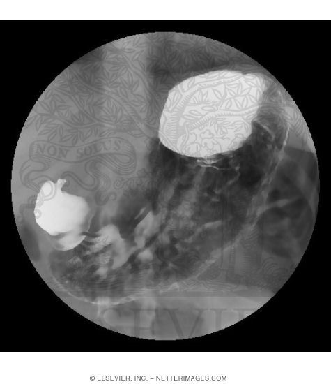 Upper Gastrointestinal CT Studies