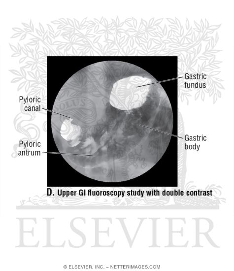 Upper Gastrointestinal CT Studies