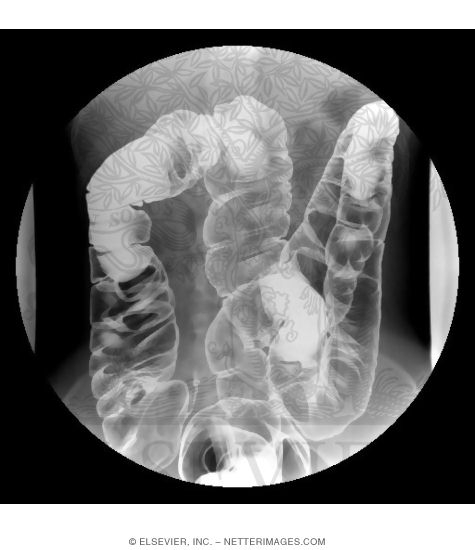 Watermarked preview of unlabeled image: Large Intestine Imaging Studies