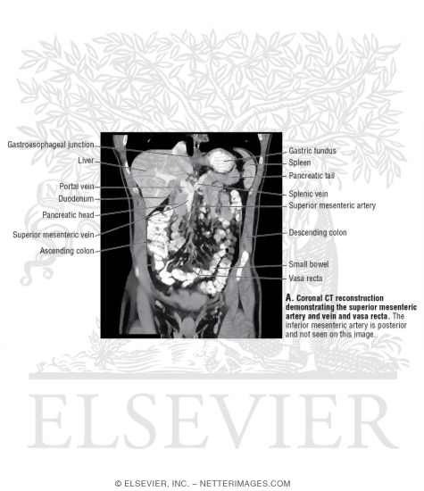 Angiograms of the Superior and Inferior Mesenteric Vessels