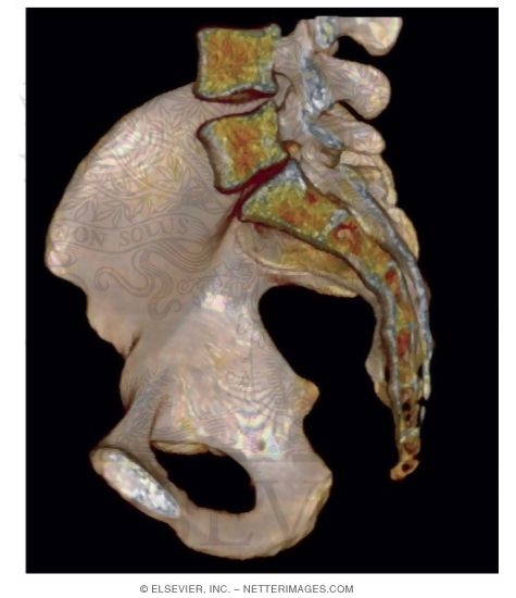 Medial View of Pelvis CT Reconstruction