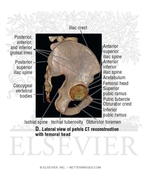 Watermarked preview of unlabeled image: Lateral View of Pelvis CT Reconstruction With Femoral Head