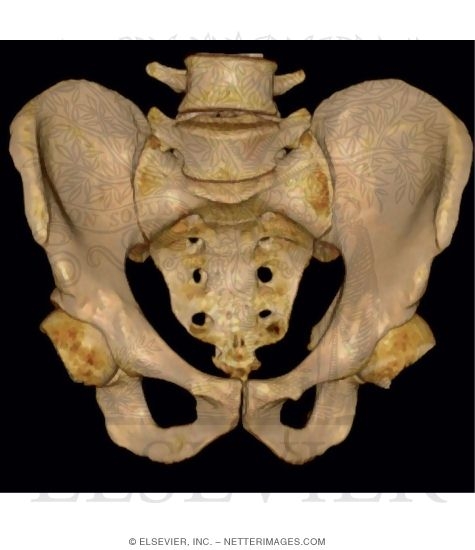 Anterior View of Pelvis CT Reconstruction With Femoral Head