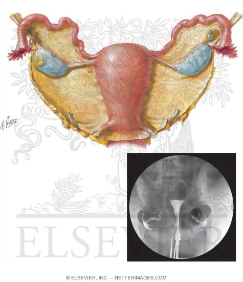 Uterus, Adnexa, and Hysterosalpingogram