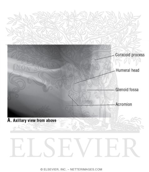 Shoulder: Axillary View From Above