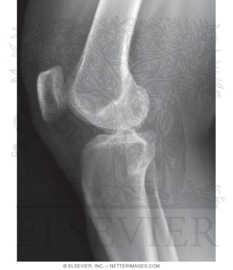 Lateral X-Ray of the Knee Joint