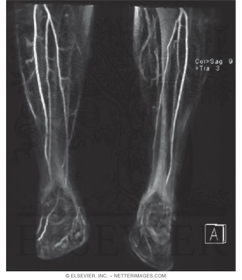 Watermarked preview of unlabeled image: Magnetic Resonance Angiogram (MRA)