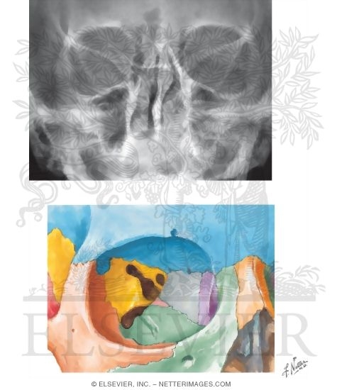 Skull: Anteroposterior Caldwell Projection and Face and Orbit Detail