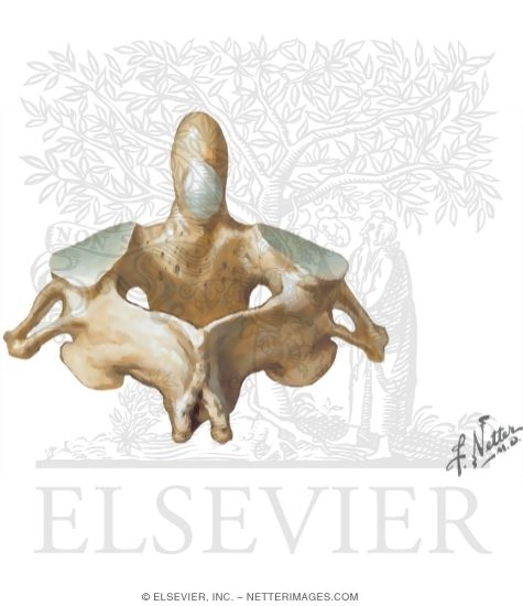 Watermarked preview of unlabeled image: Axis (C2) Posterosuperior View