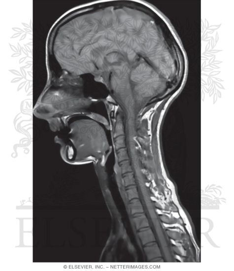 T1-Weighted MRI of the Head and Neck In Midsagittal Section