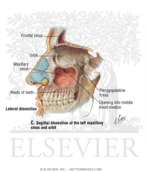Paranasal Sinuses: Lateral Dissection