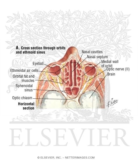 Ethmoid Air Cells and Sphenoid Sinus