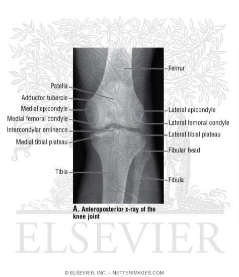 Watermarked preview of unlabeled image: Anteroposterior X-Ray of the Knee Joint
