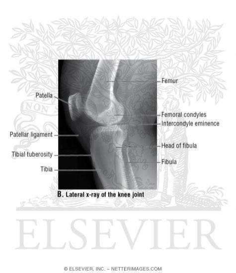 Lateral X-Ray of the Knee Joint