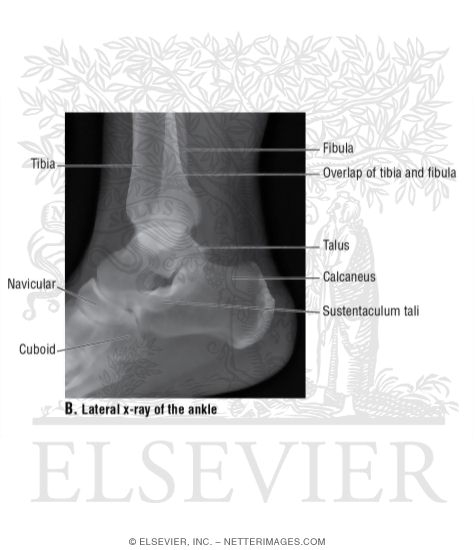 Lateral X-Ray of the Ankle