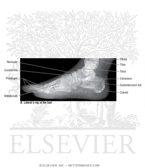 Lateral X-Ray of the Foot