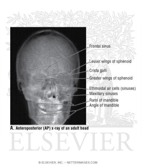 Anteroposterior (AP) X-Ray of an Adult Head