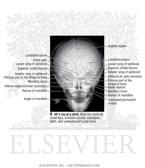 Watermarked preview of unlabeled image: Anteroposterior (AP) X-Ray of a Child