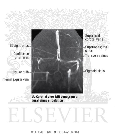 Thesis venography 08 picture