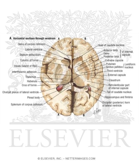 Watermarked preview of labeled image: Cerebral Cortex and Basal Ganglia, Axial Section