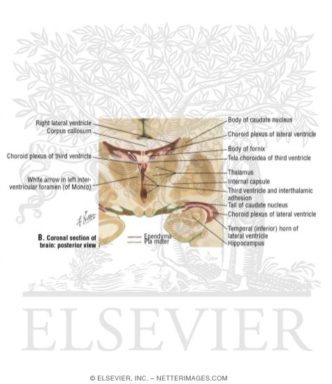 Watermarked preview of labeled image: Ventricular Anatomy In Coronal Forebrain Section
