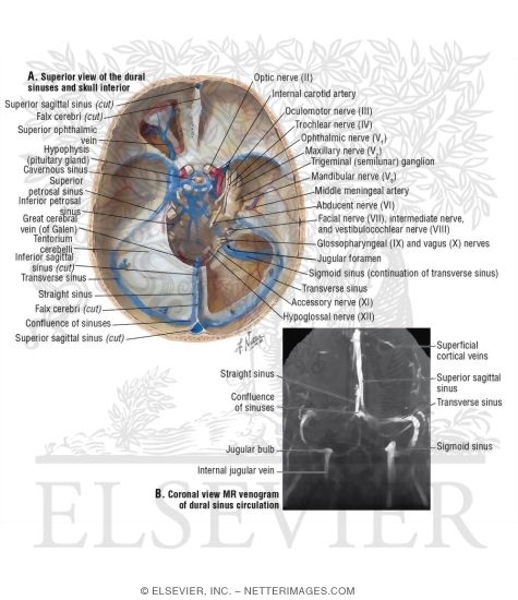 Dural Venous Sinuses Dural Venous Sinuses