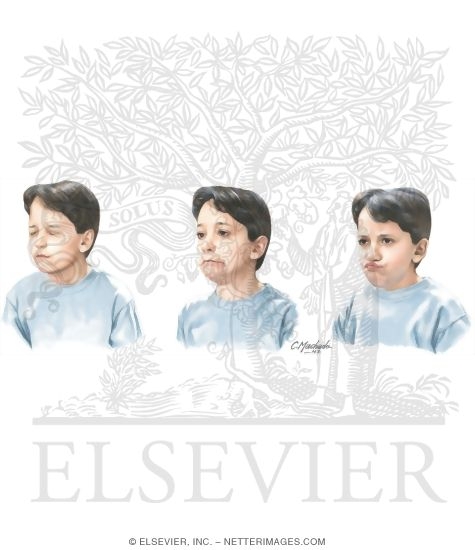 Watermarked preview of unlabeled image: Common Motor Tics