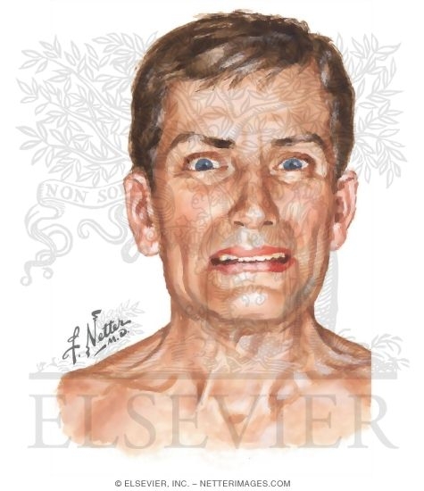 Acute Dystonic Reaction