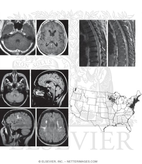 Watermarked preview of unlabeled image: Lyme Disease